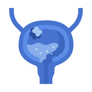 oncólogo, doctor, cáncer, vejiga